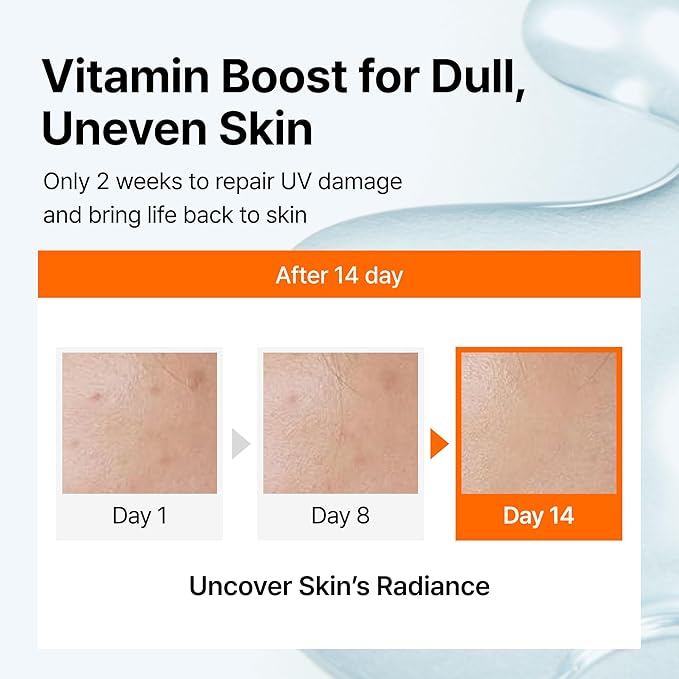 DearKlairs Freshly Juiced Vitamin Drop, 5% Hypoallergenic pure vitamin C serum, 1.18oz | Ascorbic acid, antioxidant for face, korean skincare