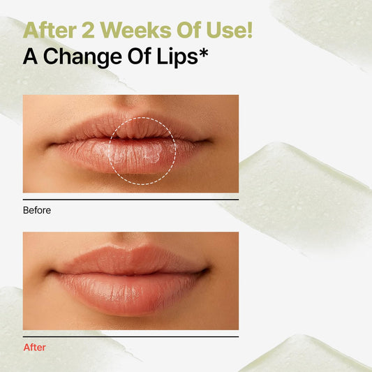 Dr.Different Retinal Lip Balm Clear, Anti-Wrinkle Lip Treatment with Deep Hydration & Long-Lasting Moisture, K-Skincare made by Korean Dermatologist, 0.14oz