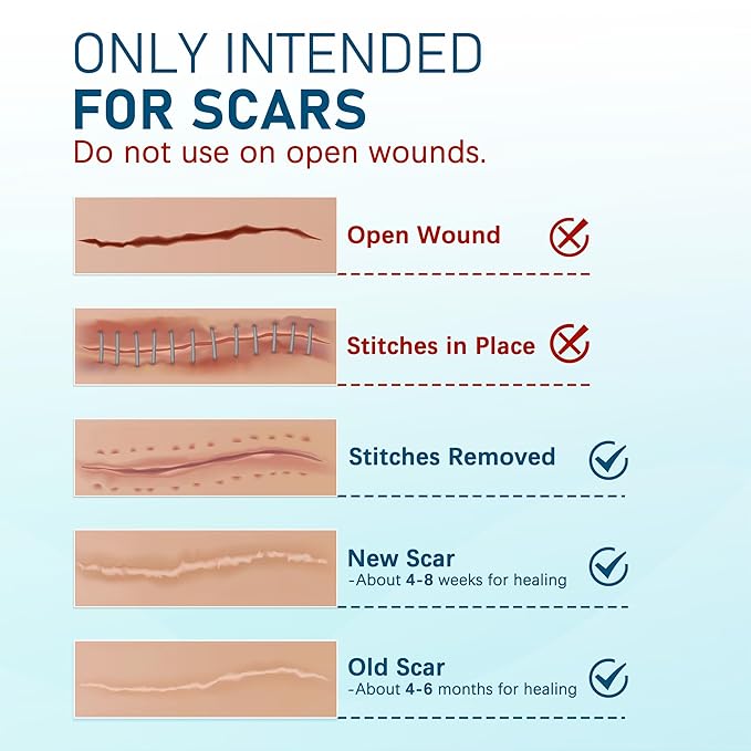 Silicone Scar Sheets, 10pcs, Silicone Tape for Scar Treatment, Reusable Scar Strips for Surgical, C-Section, Keloid Bump, Stretch Marks, Burn, Acne Scar Removal, Each 1.5” x 6”