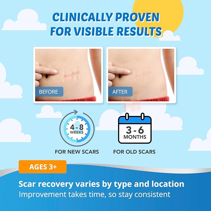 Kids Silicone Scar Gel: Silicone Gel for Scars - Reduces the Appearance of Old and New Scars - Advanced Scar Gel for Face - Body - Scratches - Injuries - Scalds - Burns - Surgery - Kid Friendly - 20g