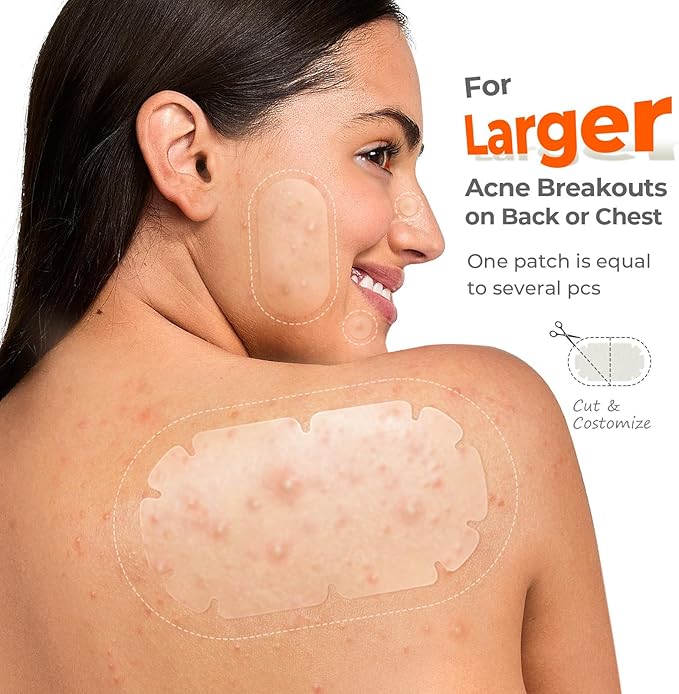 XXL Pimple Patches for Body, Large Hydrocolloid Acne Patches, 5 Sizes Big Hydrocolloid Bandages for Back, Chest, Shoulders Zit Breakouts, Blemish Patch for Face (Oval, Dot 260 Count)