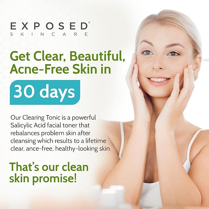 Exposed Skin Care Clearing Tonic Facial Toner with 1% Salicylic Acid and Witch Hazel for Acne Treatment – Pore Minimizing Toner to Prevent Breakouts, Reduce Redness and Balance Skin – Step 2 (4 fl oz)