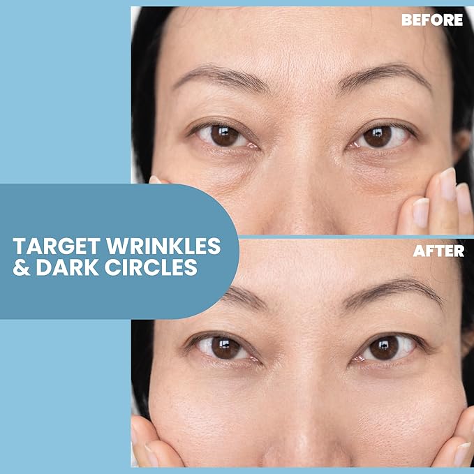 Anti-Aging Eye Gel - Luxurious Hydrating Under Eye Cream For Dark Circles and Puffiness, Bags, Crows Feet, Wrinkles - With Hyaluronic Acid & Skin-Firming Peptides Serum (1 oz)