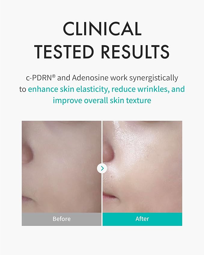 REJURAN® Turnover Mask, c-PDRN® (5ea) – Original Salmon DNA Daily Mask for Firming, Hydration, Repairing & Revitalizing. Achieve Youthful, Radiant Skin. Korean Skincare. Ultra Microfiber Sheet Mask