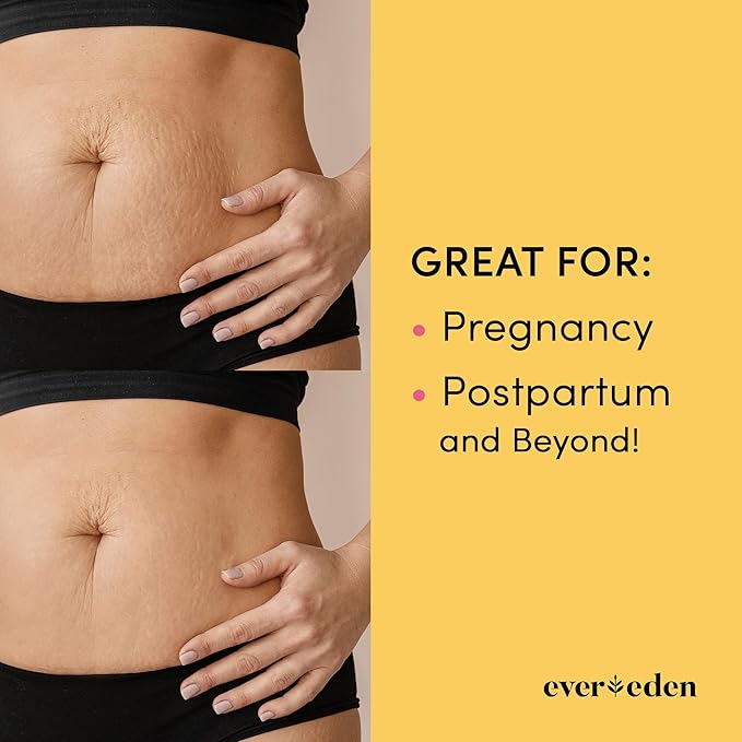 Evereden Nourishing Stretch Mark Cream 50ml