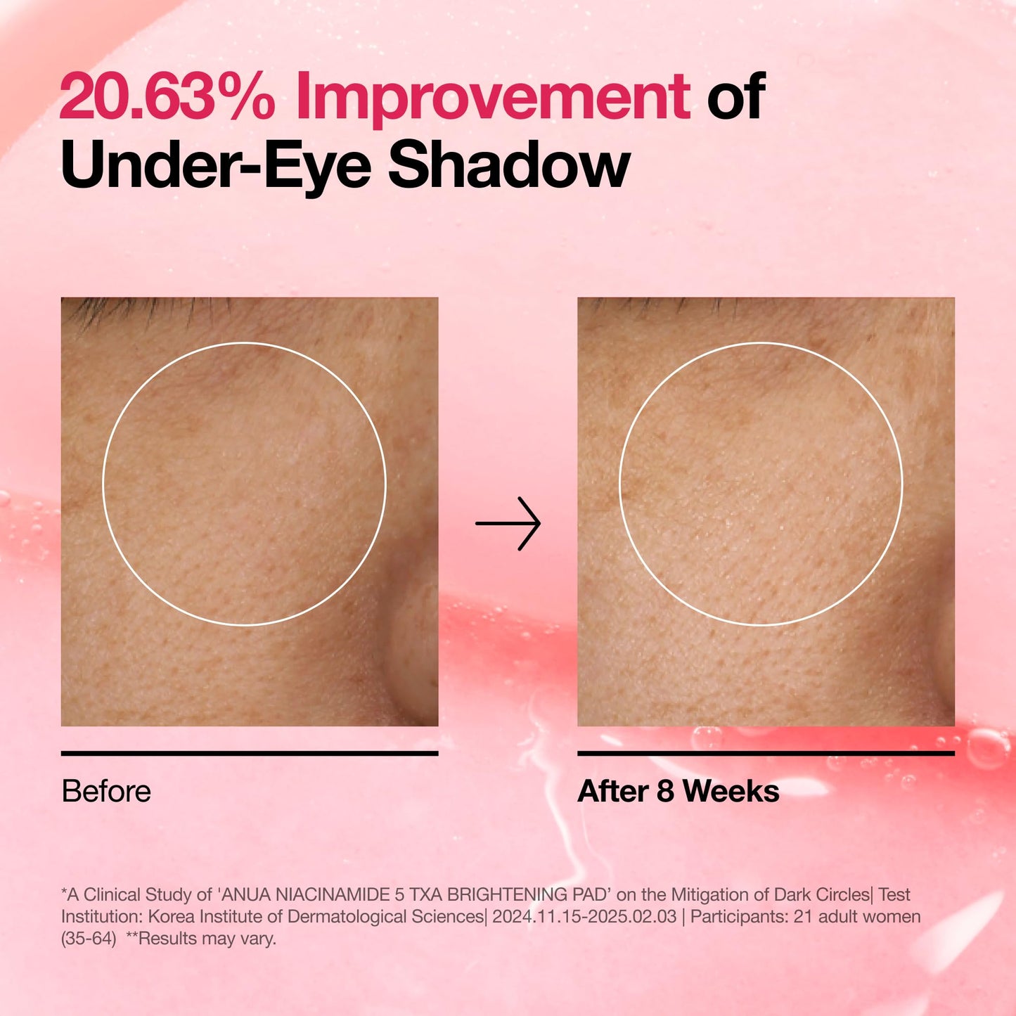 Anua Niacinamide 5 TXA Toner Pads – Hydrating Facial Pad for Even-Looking Skin Tone & Daily Radiance Care, Glow up Under-Eye with Tranexamic Acid, Korean Skin Care (210ml, 60 Pads)