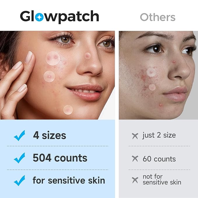 Pimple Patches for Face (504 Count), FSA Eligible Acne Patch Bulk, Zit Stickers 4 Sizes, Hydrocolloid Spot Stickers, Clear Acne Dots for Covering Zits, Blemishes and Breakouts