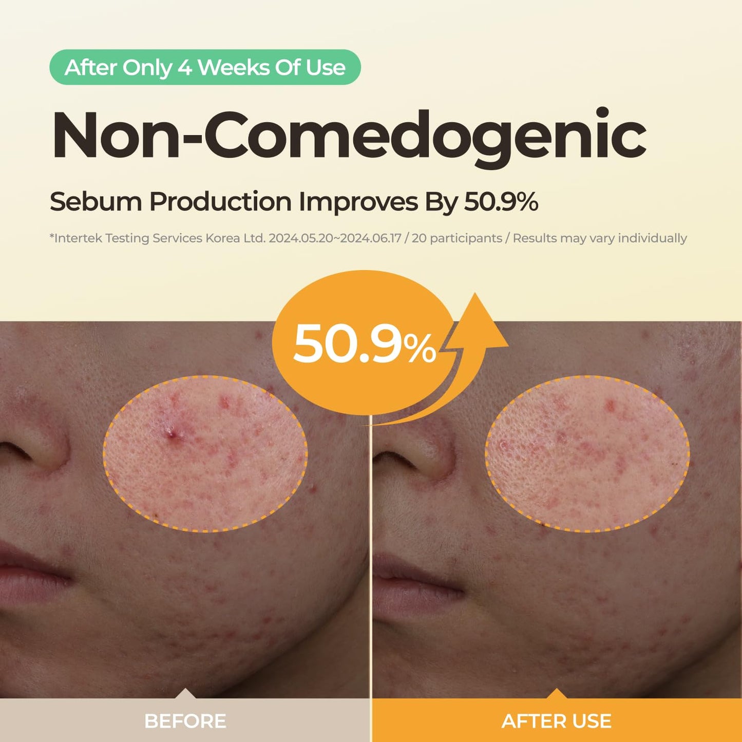 SINSURU Sulfur Hot Spring Water 65% Repair Cream, Daily Face Cream Moisturizer for Dry Skin, Acne-prone, Sensitive Skin, Korean Skin Care (1.69 fl.oz. 50ml)