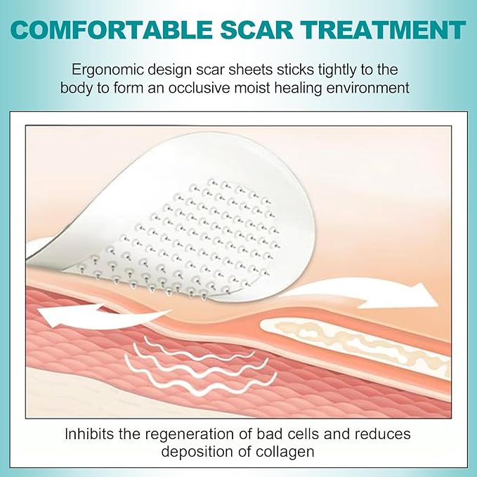 Extra Long Silicone Scar Sheets (1.6”