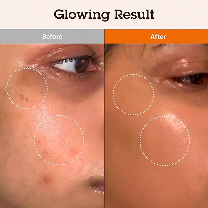 BLITHE Niacinamide 5% + Tranexamic Acid 3% Serum, Dark Spot Corrector - Vitamin B3 Niacinamide for Face, Skin Soothing Cica & Allantoin, Arbutin & Tranexamic Acid, 1oz