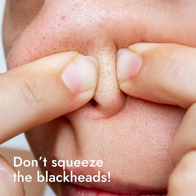 Epielle Over-Zit Nose Patches | Ultimate Hydrocolloid Solution for Clear Skin | 10 Acne Pimple and Blemish Patches for Nose