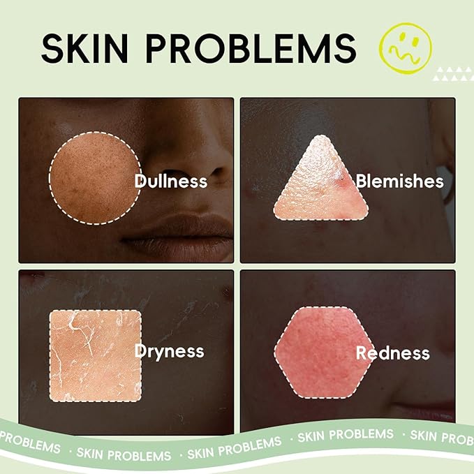 Fruit Skincare, Skin Care Gift Sets, Skin Care for Teens 10-12, with Lip Balm *6, Facial Cleanser, Serum, Eye & Face Cream, Hands Cream *5 , Nourishing, Hydration, Glow Up, Trendy Stuff