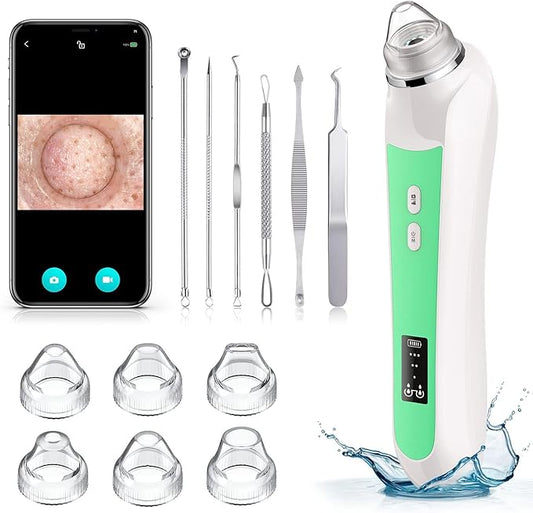 Facial Pore Blackhead Remover Vacuum, 1080P Camera Blackhead Remover, 20x Zoom, 8 LEDs ＆ 3 Suction Modes, 800mAh Battery & USB - 6 Heads Pore Cleaner Kit for Women&Men(Green)