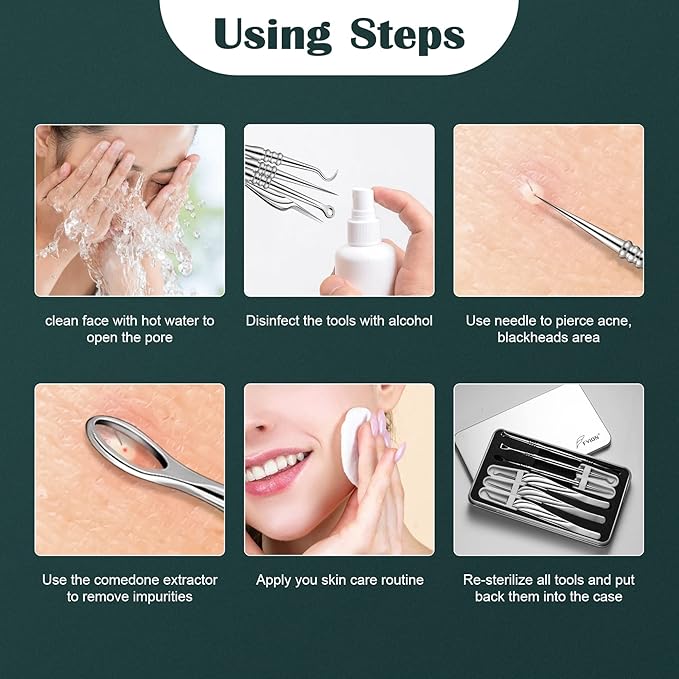 FVION Blackhead and Acne Extractor Kit, Professional Pimple Popper Tool Kit, Acne Tweezers and Blackhead Remover Tools for Face, 6 PCS Surgical Extractor Pimple Popping Tools