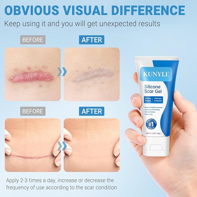 Silicone Scar Gel, Scar Cream, Advanced Scar Stick for Surgical Scars, Stretch Marks, Keloid Bump Removal, Old and New Scars 2.11oz (60g)