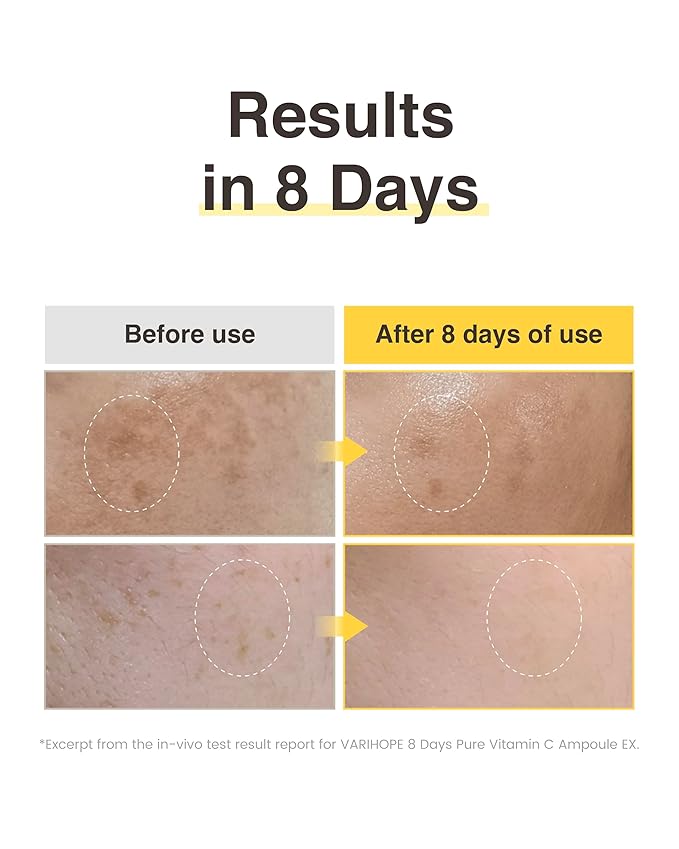 8 Days Vitamin C Serum - High-Potency Ascorbic Acid for Brightening, Dark Spot Care & Even Skin Tone, Korean Skin Care Ampoule for Glowing, Radiant Skin, 0.5 fl oz
