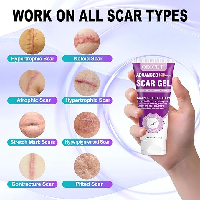 Silicone Scar Gel - 16.5% Complex Active Repair Scar Cream, 2.1 oz for Stretch Marks & Surgical Scar Treatment, Keloid Care for All Skin Types. Effective on New & Old Scars, Pregnancy, Keloids-Purple