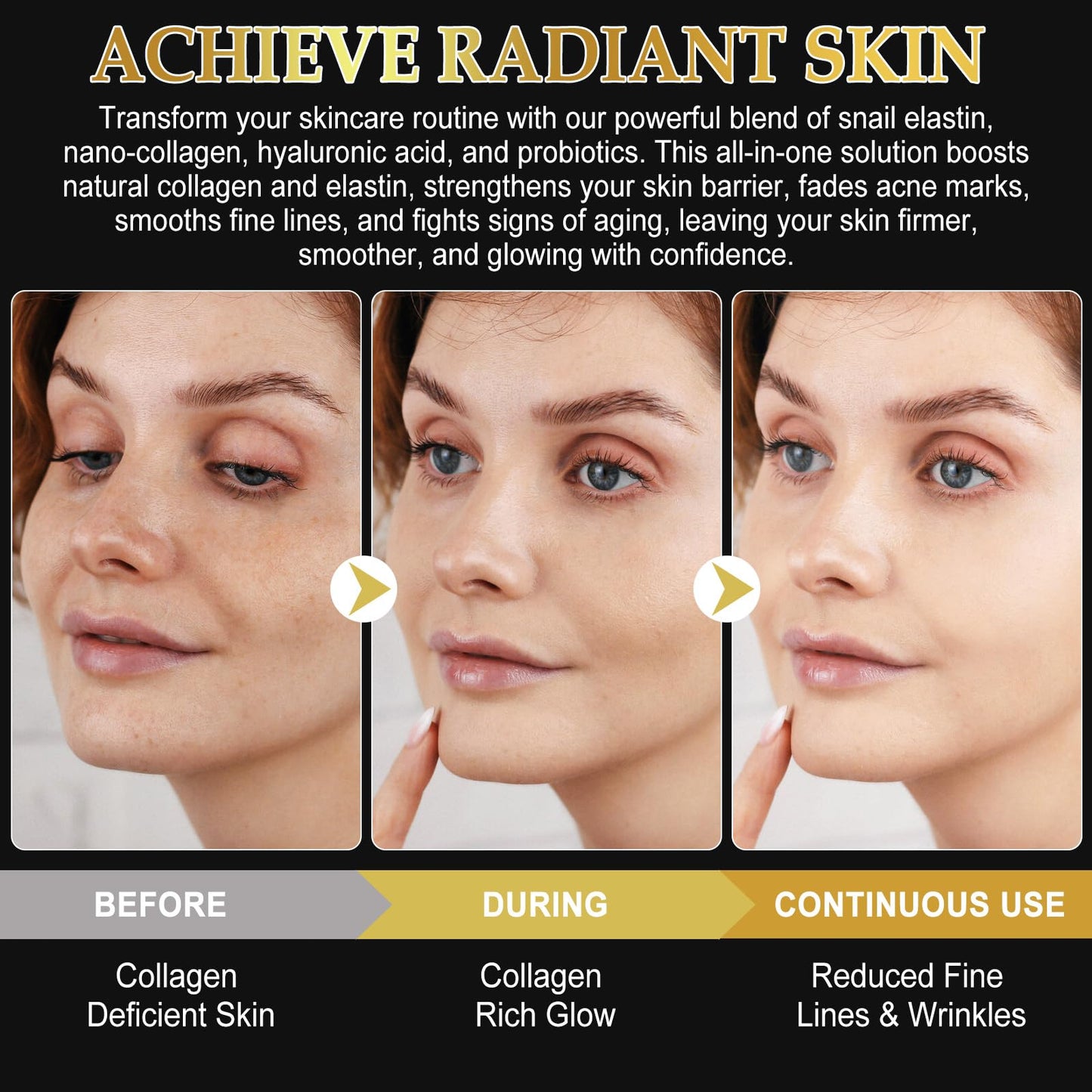 Snail Mucin Mask - Collagen Face Mask, Hydrating Mask Sheet with Hyaluronic Acid, Anti Wrinkle Anti Aging Deep Moisturizing Natural Snail Mucin Serum Daily Treatment for Dry, Sensitive Skin (6 PCS)