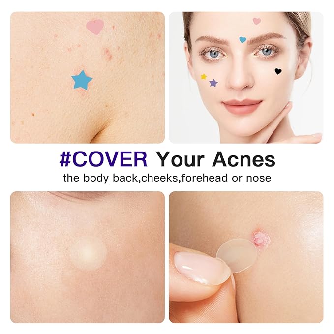 312CT Acne Patches For Face Hydrocolloid,Salicylic Acid,Star Pimple Patches 5Sizes 6Colors Cute Stickers
