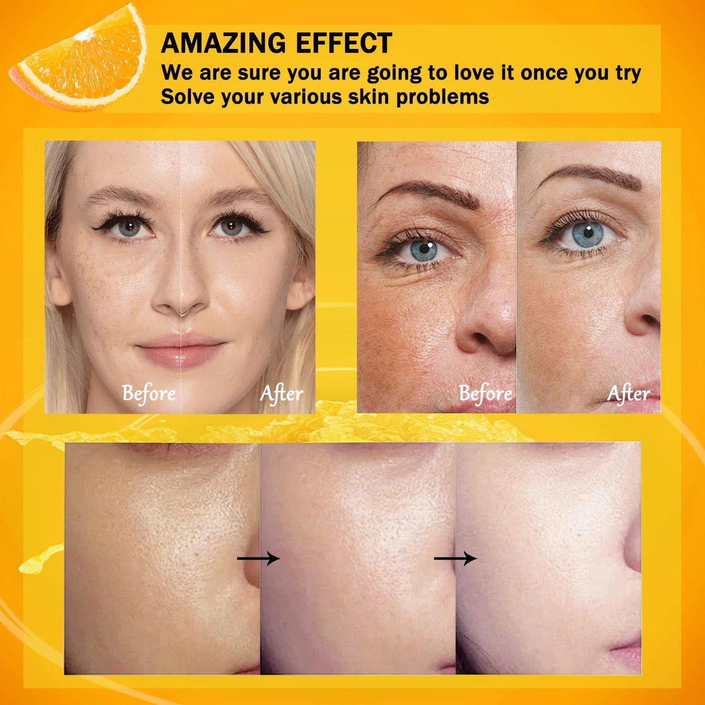 Vitamin C Skincare Set, 5Pcs Skin Care Sets for Women, Facial Kit, Vitamin C Face Skin Care Kit With Cleanser, Toner, Face Serum, Eye Cream, Cream, Long-Lasting Moisturizing Skincare Set