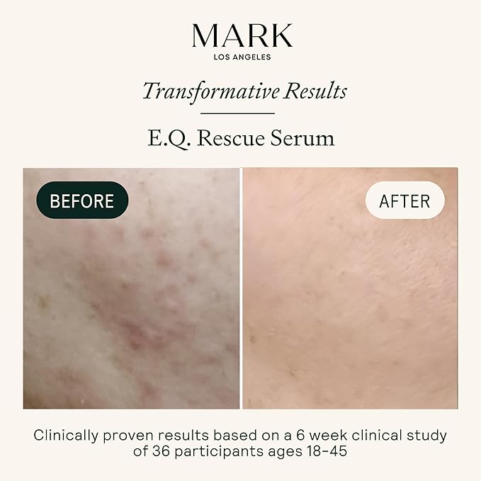 EQ Rescue Face Serum - Facial Serum with EGCG & Quercetin to Reduce Blemishes, Redness & Irritation - Fragrance-Free, Non-Comedogenic, Clinically Tested - 1 fl oz