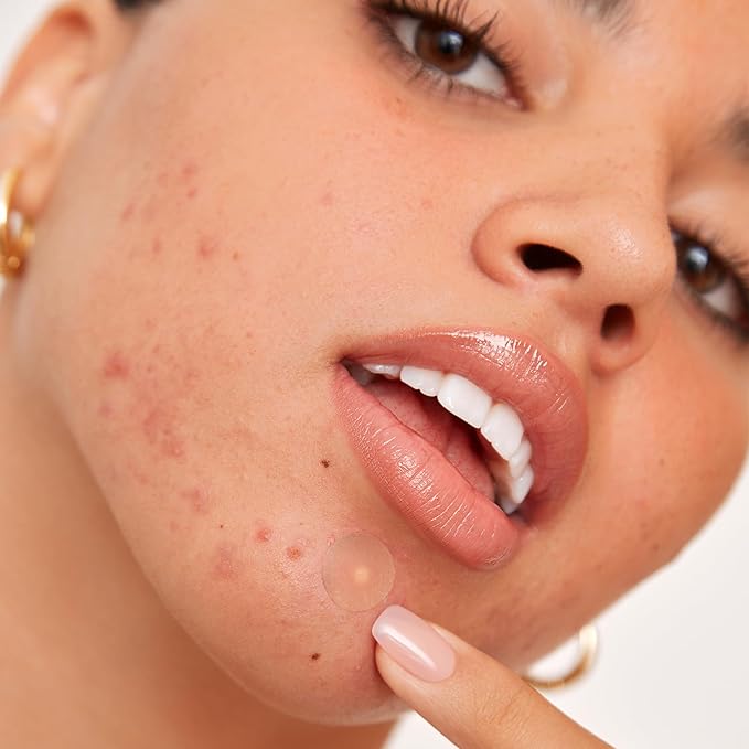 PEACE OUT Acne Healing Dots Helps Clear Blemishes Overnight, Fast Acting Hydrocolloid Pimple Patches for Breakouts with Salicylic Acid, Retinol and Aloe Vera, Award Winning Skincare Solution 10 Count