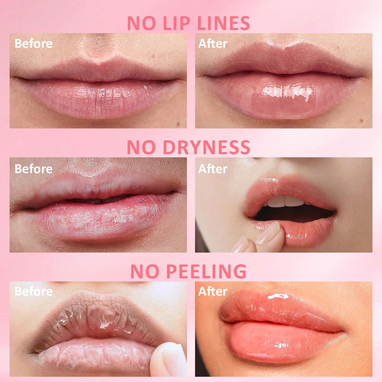 DMSKY 6 PCS Bee Lip Balm Honey Pot, Nourish & Hydrate Lip Sleeping Mask with Vitamin E, Lip Mask Overnight for Dry Lips, Reduces Lip Lines