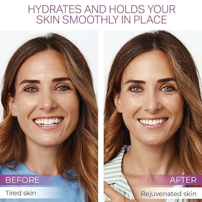 Furlesse Rows Wrinkle Patches, Overnight Forehead Anti-Aging