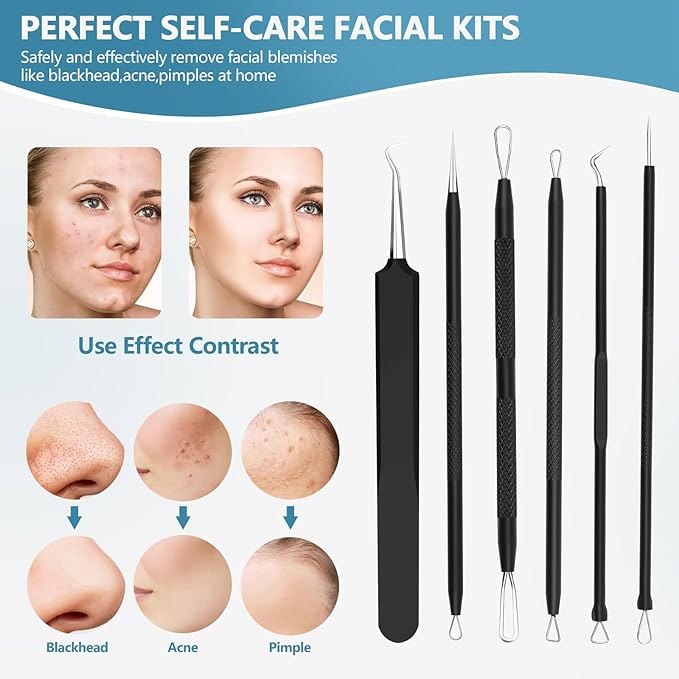 Pimple Popper Tool Kit,Blackhead Remover Tool 6 Pcs Blackhead Extractor Tool for Face Comedone Zit Acne Whitehead Blemish, Stainless Steel Extraction Tools Set