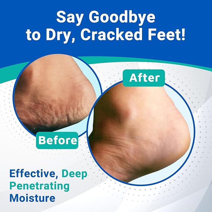 Dermal Therapy Heel Care Cream - Moisturizing Treatment that Repairs and Heals Dry, Rough, Cracked Heels and Feet | 25% Urea and 6% Alpha Hydroxy Acids (3oz+8oz Bundle)