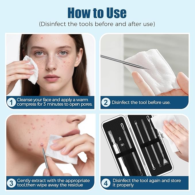 Blackhead Remover Tool Kit, 6 Pcs Pimple Popper Comedone Extractor Set with Acne Needles, Tweezers, Pore Scraper for Blemish, Zit, Whitehead Removal on Nose and Face, with Storage Case