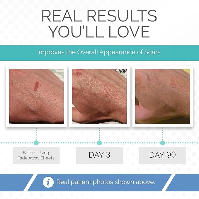 Fade Away Scars - Original Silicone Scar Sheeting Roll- Custom Size Medical Grade- Effective Silicone Scar Sheets, Strips and Patches for Scars, Surgical Scar Tape, Silicone Scar Sheets.