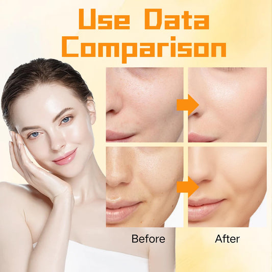 Skincare Set Vitamin C Girls Gifts - Skin Care Set Antioxidant - Hydrating Skin Care Kit for Women with Sunscreen,Toner,Serum,Eye Cream - Skin Care for Teens 10-12 (One Size, 8PCS Vitamin C Scent)