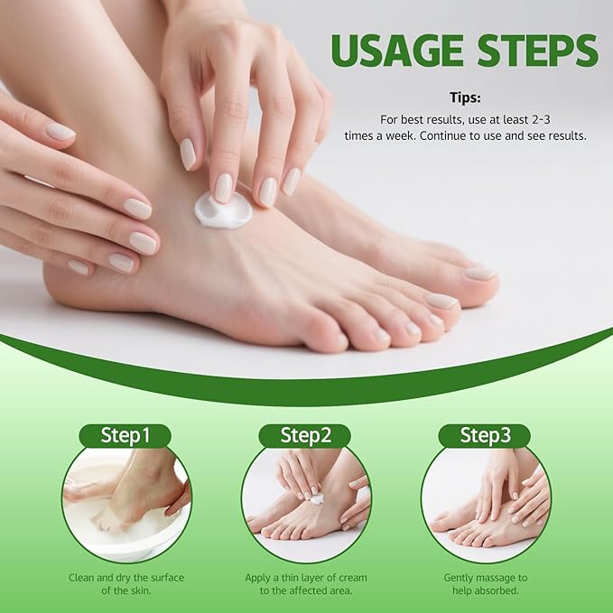 Urea Cream 60 Percent for Feet, Urea Foot Cream for Dry Cracked Heels and Feet, Cracked Heel Repair Cream, Foot Moisturiser, 5.29oz/150g