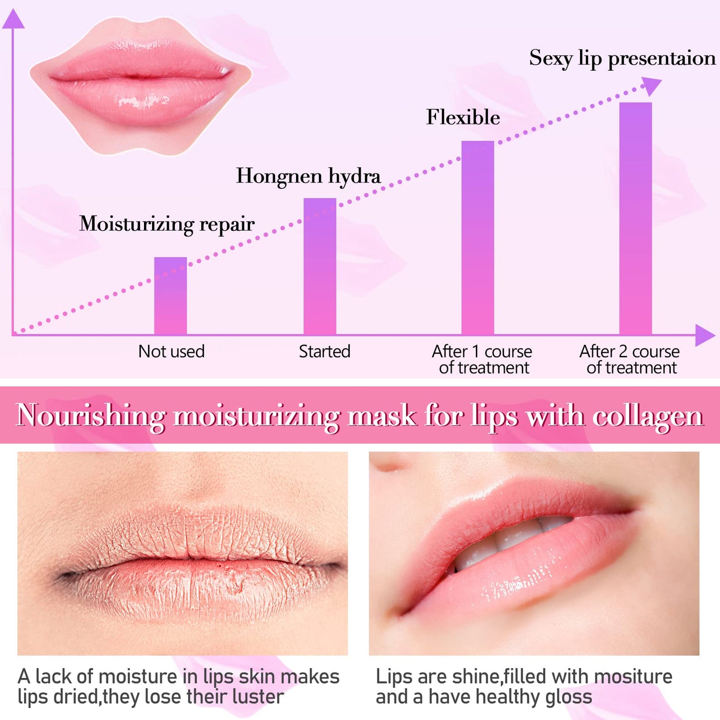 50PCS Lip Mask Sheet,Collagen Crystal Lip Masks,Pink Lip Care Pads Mask for Moisturizing Nourishing,Anti-Aging & Anti-Wrinkle,Lip Gel Patches Pads for Dry Lip,Remove Dead Skin