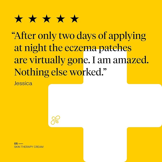 FIRST HONEY® Manuka Honey Cream for Dry & Itchy Skin | Fast Relief for Eczema, Rosacea, Psoriasis, & Dermatitis | Natural & No Fillers | Safe for Babies & Toddlers | 3.5 oz