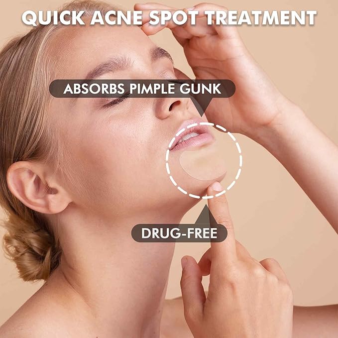 Albatross Health New England Large Acne Pimple Patches for Face, Chin, Back and Body (10 Counts), Spot Dots Cover, Hydrocolloid Treatment Stickers, Zit Blemish Patch