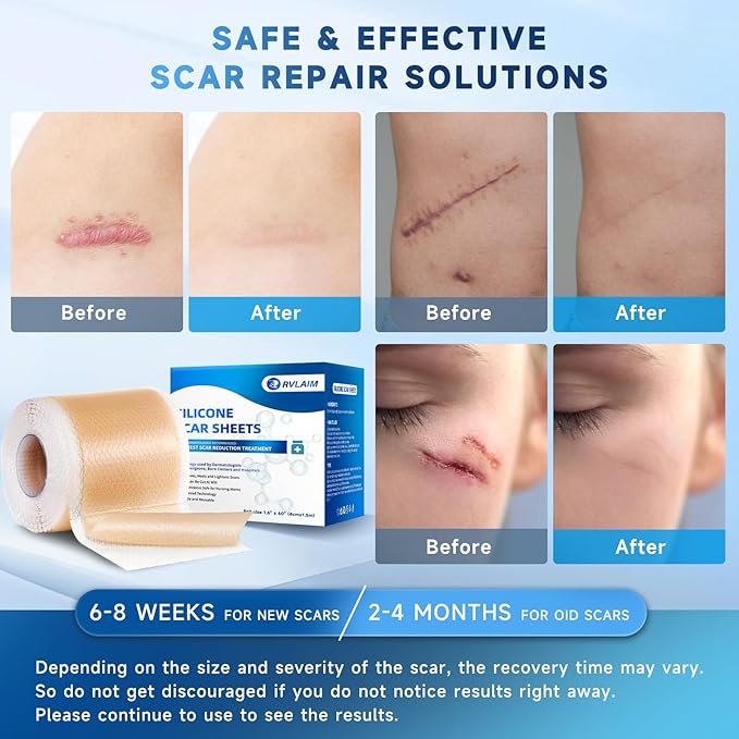Silicone Scar Sheets, Silicone Scar Tape(1.6” x 60” Roll 1.5M), Silicone Scar Sheets for Surgical Scars, Keloid Bump Removal, Stretch Marks Removal, C-Section, Burn et
