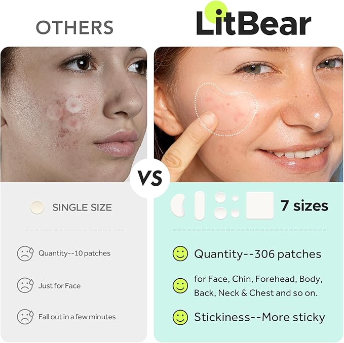 LitBear Large Pimple Patches (7 Sizes 306 Patches), Big Acne Patches, XL Hydrocolloid Bandages for Full Face, Forehead, Chin, Nose, Body, Back, Neck & Chest, Oval, Moon, Square hydrocolloid Patch