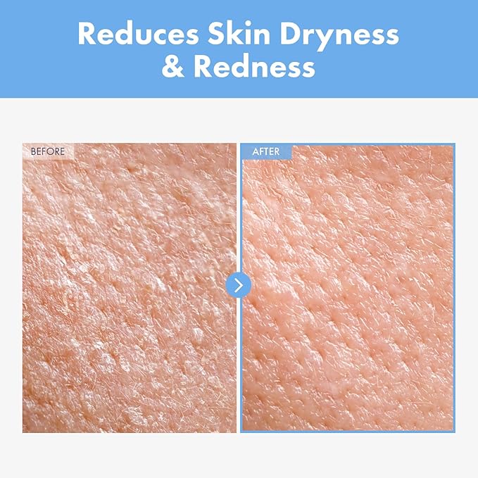 Cica Panthenol Cream, 50,000ppm Panthenol, Centella Asiatica & Hyaluronic Acid, Barrier Repair Moisturizer for Dry, Sensitive Skin, Korean Skincare, 150g, 5.29 oz.