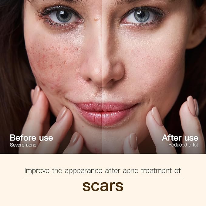 Madagascar Centella, Facial Serum for face, Natural Extraction of Bakuchiol, Centella Asiatica Extract for Soothing Sensitive& Acne-Prone Skin, for Scars, Moisturizing& Firming- 45ml