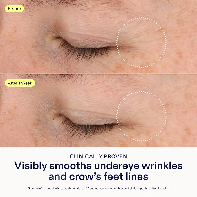 Skinfix Triple Lipid-Boost 360 Eye - 0.5 fl oz Refill - Clinical Proven to Visibly Smooth Undereye Wrinkles & Crow’s Feet Lines - Non-Comedogenic - Vegan, Cruelty Free