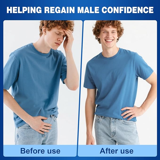 Balanitis Treatment for Men: Balanitis Relief Cream for Men's Intimate Health, Soothing Itch, Rashes, Redness, Irritation, and Swelling, 30g