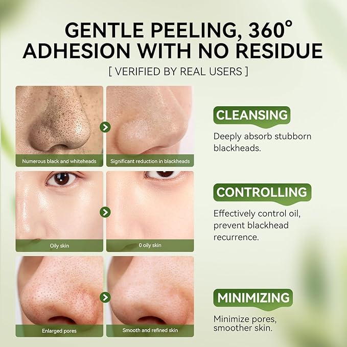 LANBENA 3-in-1 Blackhead Removal Set - Bamboo Charcoal Pore Strips (30g), Pore Minimizing Serum (30ml) & Removal Paper - Mask for Face, Minimizes Pores & Leaves Skin Fresh & Clean, Blackhead Remover