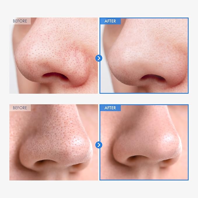 AHA Deep Cleansing Facial Oil with Jojoba Oil, Tea Tree Oil, PHA and Centella Asiatica, Korean Blackhead Remover, Pore Cleaner and Sebum Remover, 145ml, 4.9 fl. oz.
