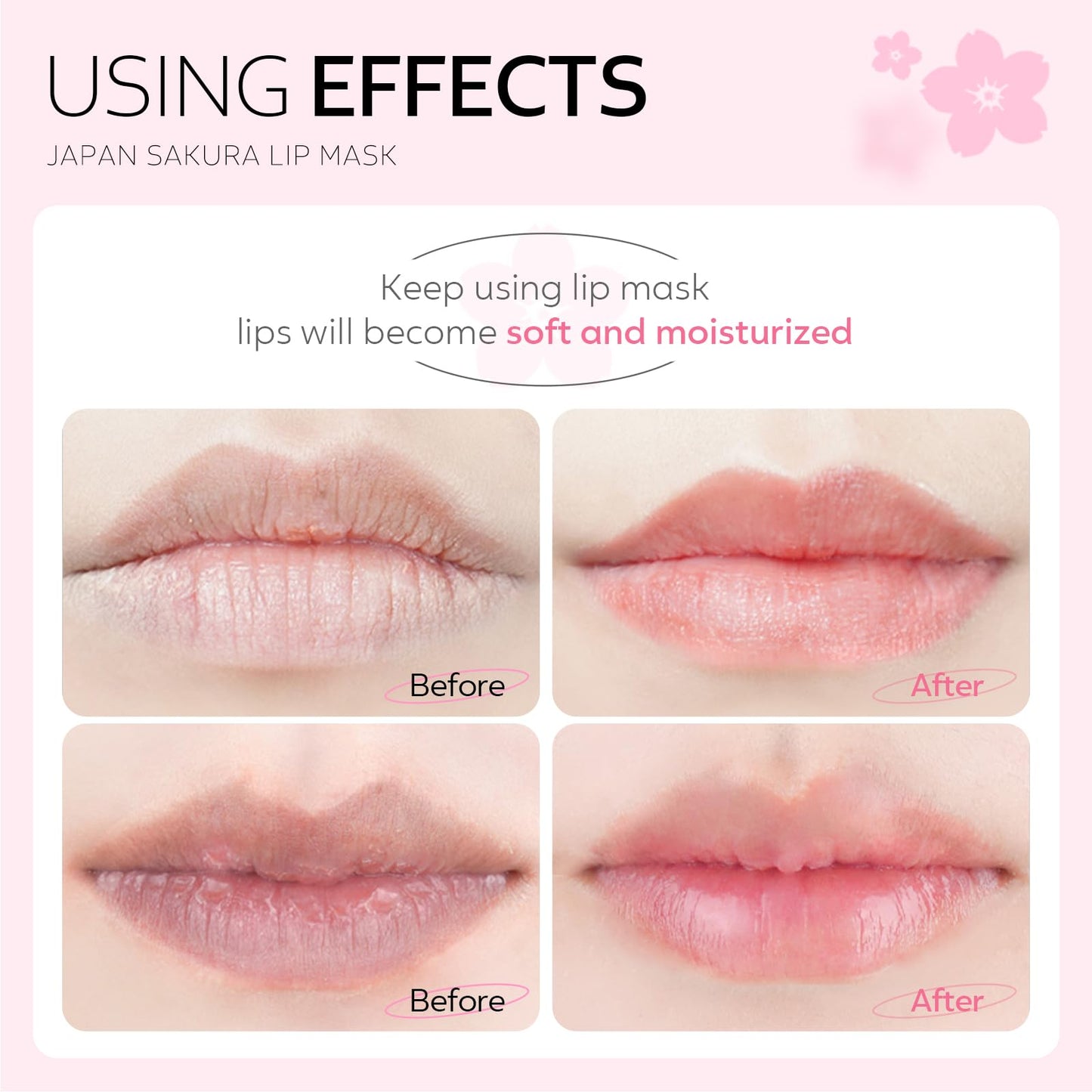 AKARY Sakura 5 Pieces Hydrating Lip Mask, Lip Sleep Mask Collagen Crystal Lip Care Gel Pads For Moisturizing, Minimize Fine Lines, Remove Dead Skin, Anti Chapped Pads Lip Mask (5)