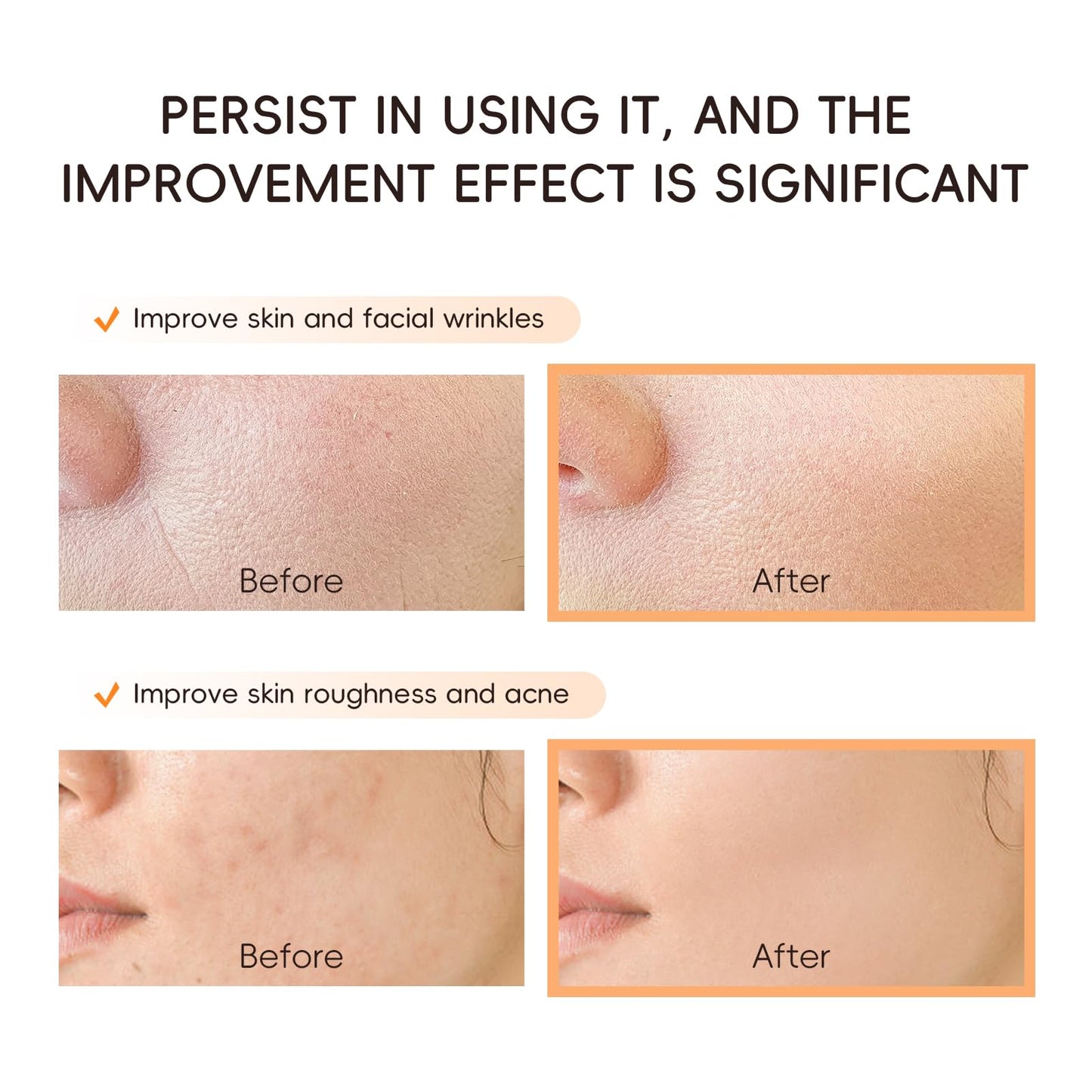 Skin Care Sets, Snail Mucin Skincare 3PCS, 97.5% Pure Snail Slime Extract Moisturizer, Serum, Face Wash Cleanser, for Moisturizing Repairing, Skin Care Routine Kit for Women, Gifts Sets