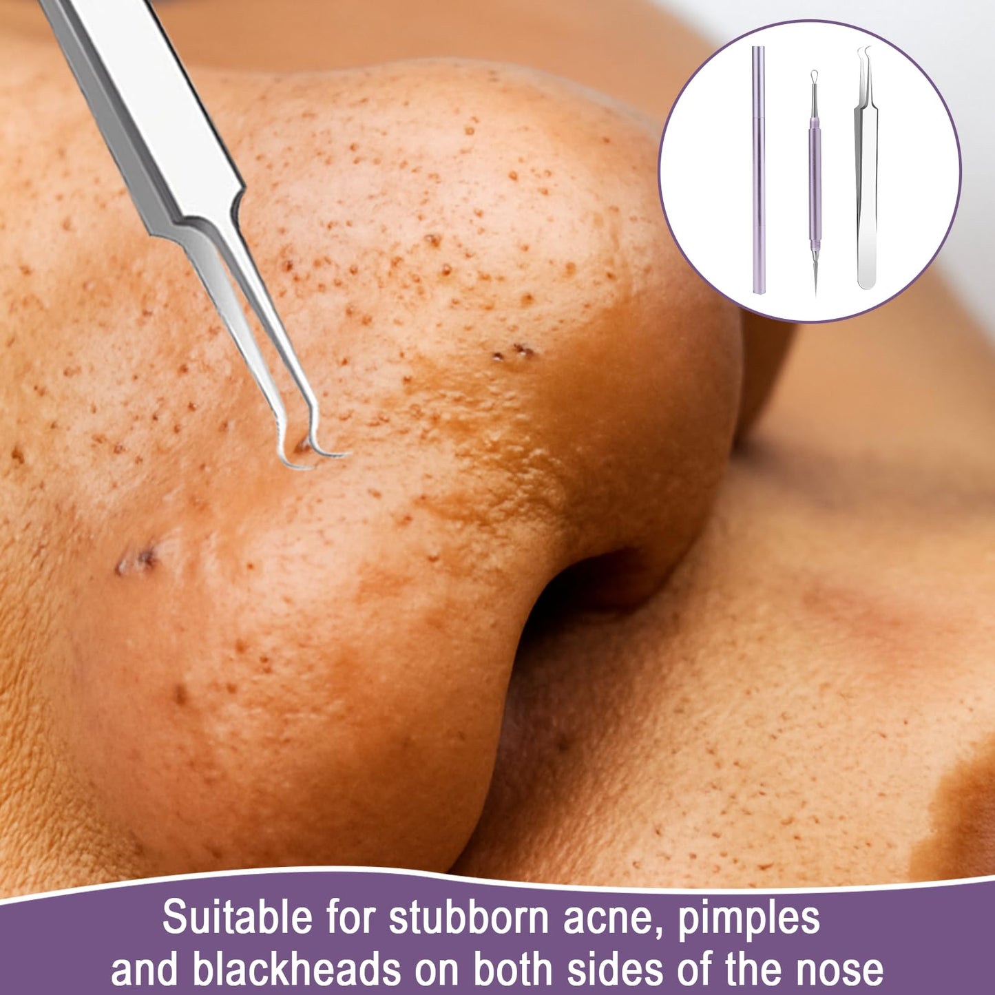 Nouiseuns Blackhead Tool Set for Face, Purple Stainless Steel Acne Extractor and Whitehead Extractor Tool – 2Pcs Professional Pimple Remover Kit with Angled Tweezers & Loop Needle for Nose & Skin Care