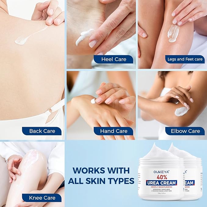 OUKEYA Urea Cream,NEW FORMULA Urea Cream 40 percent for Feet Maximum Strength,Dry Cracked Treatment Lotion for Knees & Elbows,Foot Dead Skin Cuticle Callus Remover Toenail Softener,5.29 oz（2 Packs