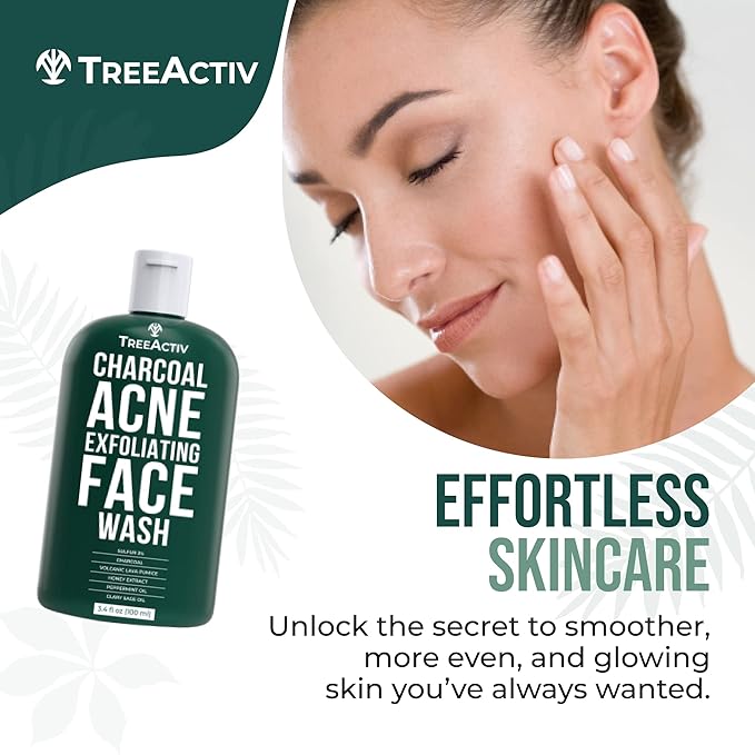 TreeActiv Acne Charcoal Face Wash 3.4 oz, Exfoliating Daily Honey & Sulfur Face Wash - Sulfur Acne Treatment Cleanser Face Soap, Mens Face Wash, Deep Cleansing Moisturizing Face Wash for Women and Men